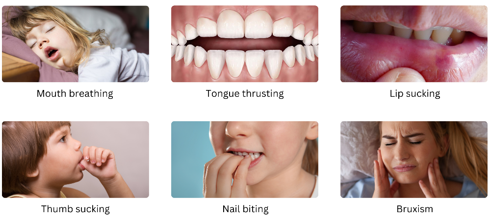 Oral habits screening — mouth breathing, tongue thrust, thumb sucking